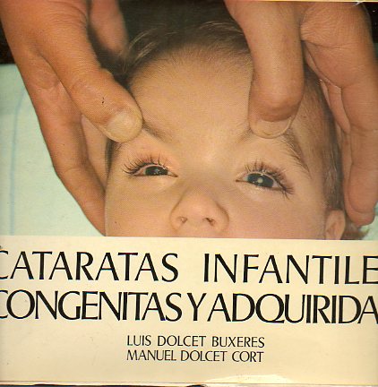 CATARATAS INFANTILES, CONGNITAS Y ADQUIRIDAS.