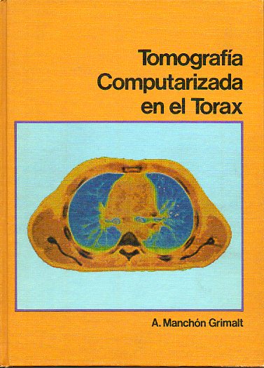 TOMOGRAFA COMPUTERIZADA EN EL TORAX.