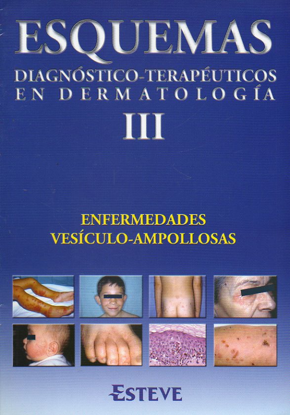ESQUEMAS DIAGNSTICO-TERAPUTICOS EN DERMATOLOGA. III. Enfermedades vesiculo-ampollosas.